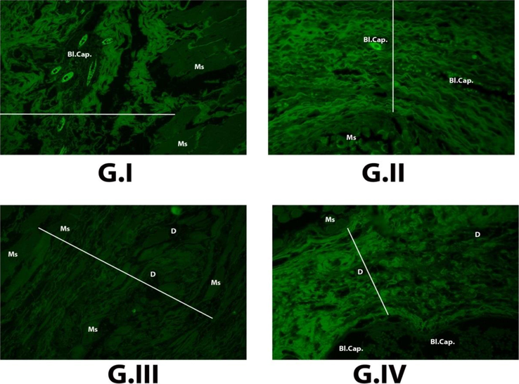 Auto fluorescence results under fluorescent microscope of the different four groups, one month postoperative (G.I): Control group showing collagen autoflourescence between healing edges of rectus abdominis muscle, which measured by image J software = 753.335, high number of blood capillaries Bl. Cap., associated with edema, and hyalinosed muscle fibers Ms (x200). (G.II): Curcumin group showing collagen autoflourescent between healing edges of rectus abdominis muscle, which measured by image J software = 514.674, blood capillaries Bl. Cap. and more or less normal muscle fibers Ms (x200). (G.III): Curcumin + Zn Al- LDH group showing collagen autoflourescent between healing edges of rectus abdominis muscle, which measured by image J software = 862.503, large sized debris of the remnant powder in the tissue D, and hyalinosed muscle fibers Ms (x200). (G.IV): Zn Al LDH group showing collagen autofluorescent between healing edges of rectus abdominis muscle, which measured by image J software = 451.100, large blood capillary Bl. Cap., small sized debris of remnant powder in tissue D, and restored muscle fibers to health state Ms (x200).