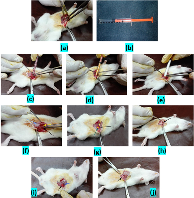 Method of surgical incision of the rectus abdominis muscle pouring in between the incision of different powders of drugs by using new convential method (a-j). Plate 1 a: Showing the surgical dissection between internal and external abdominal obliques muscles. b:Showing the insulin syringe after remove its tip for drugs application as a new convential method for drug powder pouring. c: Showing the topical application of Nano-material of Curcumin+Zn-Al LDH in between the incised wound of rectus abdominis muscle. d: Showing the topical application of Curcumin alone in between the incised wound of rectus abdominis muscle. e: Showing the topical application of Nano-material Zn-Al LDH alone in between the incised wound of rectus abdominis muscle. f: Showing the powder of Nano-material of Curcumin+Zn-Al LDH (yellow arrow) present between the external abdominal obliques muscles (blue arrow) and the internal abdominal obliques muscles (black arrow). g: Showing the powder of Curcumin (blue arrow) present between the external abdominal obliques muscles (black arrow) and the internal abdominal obliques muscles (yellow arrow). h: Showing the powder of Nano-material Zn-Al LDH (black arrow) present between the external abdominal obliques muscles and the internal abdominal obliques muscles. i & j: Suturing of muscle dissections by 4/0 vicryl (arrows).