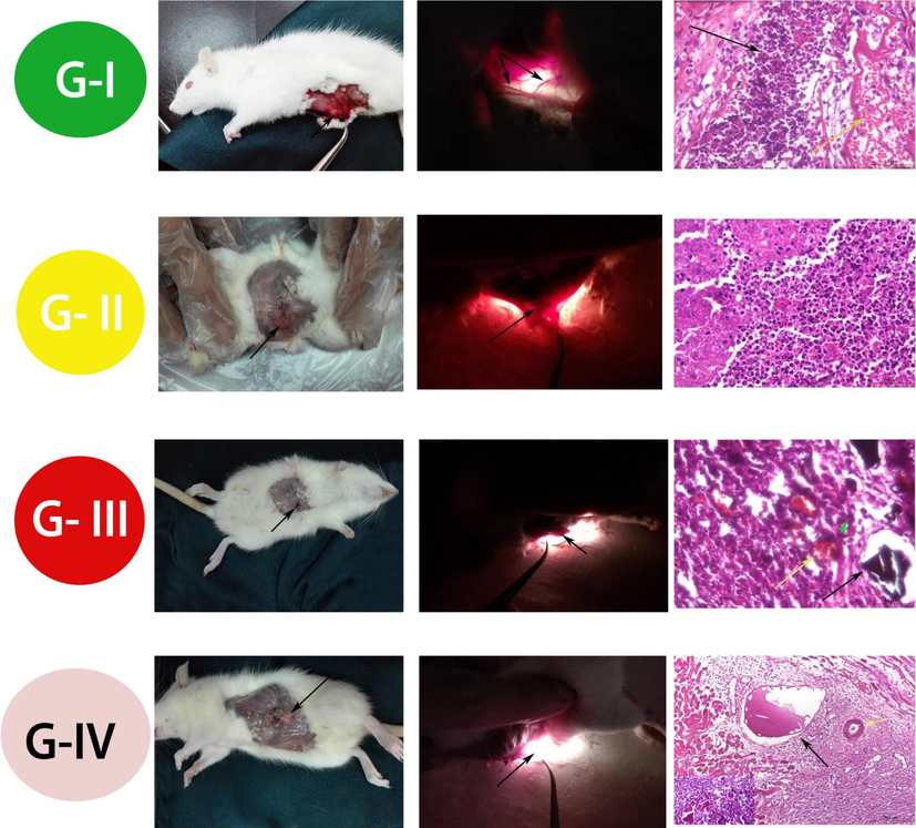 Candling, gross examination, and histopathological examination of the different four groups, one week postoperative. G-I (Control group): Grossly: Instance of congestion associated with minimal hemorrhagic spots, beginning of proliferative phase (black arrow) at the site of induced wound. Candle: Presence of prominent congested blood vessels at the site of wound (two black arrows). Histopathologically: Photomicrograph of rat rectus abdominis muscle showing prominent congested blood capillaries (yellow arrow), as well as leucocytic cells infiltrates mainly by neutrophils and macrophages as the end of the inflammatory phase of wound healing (black arrow).G-II (Group treated with Curcumin alone): Grossly: More or less normal wound site, only the drug ruminants observed at the site of wound (black arrow). Candle: No congested blood vessels and drug residue present (black arrow). Histopathologically: Photomicrograph of rat rectus abdominis muscle showing abundant leucocytic infiltrates at the site of induced wound. G-III (Group treated with Curcumin loaded on Nano-material of Zn/Al -LDH): Grossly: No congestion at the site of wound except small residue of nano-powder. Candle: No congested blood vessels but very small drug residue still present. Histopathologically: Photomicrograph of rat rectus abdominis muscle showing remnant of drug residues (black arrow), minimal leucocytic infiltrations (green head arrow), as well as congested blood capillaries at site of wound (yellow arrow).G-IV (Group treated with Zn/Al-LDH alone): Grossly: No congestion at the site of wound except abundant amount of non-absorbed residue of nanopowder (black arrow). Candle: Presence of drug residue (black arrow). Histopathologically: Photomicrograph of rectus abdominis muscle showing dilated blood capillary with edema (black arrow), with no congestion and mostly absence of leucocytic infiltrates.