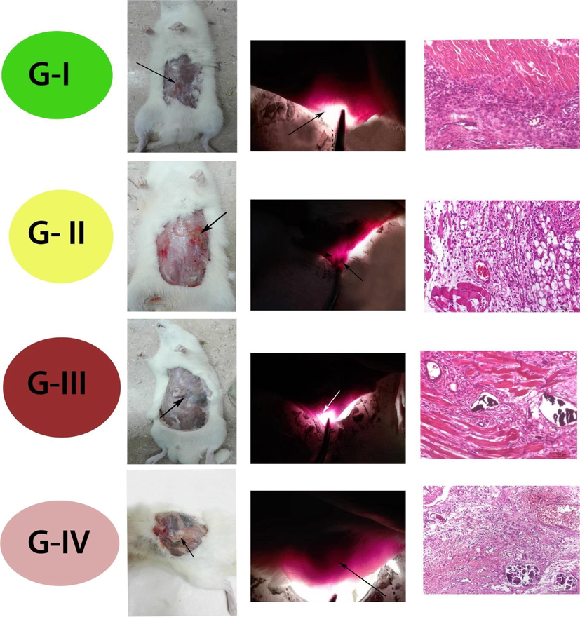Candling, gross examination, and histopathological examination of the different four groups, one month postoperative. G-I (Control group): Grossly: Presence of mild congestion at the site of wound (black arrow). Candle: Presence of very few congested blood vessels at the site of wound (black arrow). Histopathologically: Photomicrograph of rectus abdominis showing connective tissue proliferation and leucocytic infiltrates by lymphocytes (H&E; Bar= 100 µm). G-II (Group treated with Curcumin alone): Grossly: Presence of mild congestion at the site of injury with very small remnant of particles (black arrow). Candle: (black arrow and head of arrow). Histopathologically: Photomicrograph of rectus abdominis showing mild congested blood, fatty infiltrates (H&E; Bar= 100 µm). G-III (Group treated with Curcumin loaded on Nano-material of Zn/Al -LDH): Grossly: Absence of congested blood vessels and complete dissolving of nanomaterial at the site of wound (black arrow). Candle: Presence mild congested blood vessels and drug residue not present (white arrow). Histopathologically: Photomicrograph of rectus abdominis showing minimal drug residue, connective tissue proliferate with no congestion (H&E; Bar= 100 µm). G-IV (Group treated with Zn/Al-LDH alone): Grossly: Presence of Nano-powder residue and absence of congestion at the site of wound (black arrow). Candle: presence of drug residue (black arrow) Histopathologically: Photomicrograph of rectus abdominis showing wide gap distance with appearance of drug residue associated with minimal congestion (H&E; Bar= 200 µm).