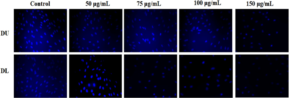 The fluorescent images of HepG2 cells incubated with various concentrations of MWCNT-PEG-AA-HBPLL-FA and DOX/MWCNT-PEG-AA-HBPLL-FA nanocarrier stained with Hoechst stain.