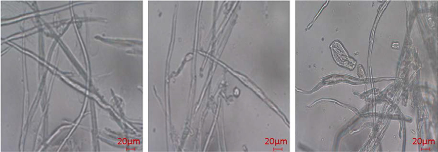 Florescence optical micrographsof cellulose.
