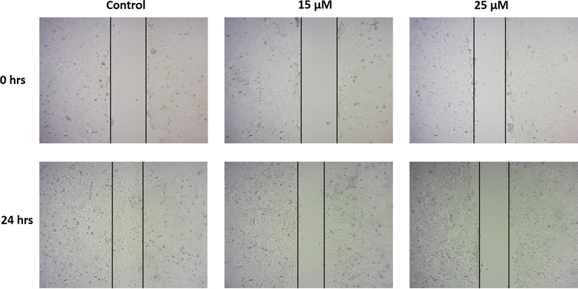 Effect of furanochrome visnagin on cancer cell migration. HeLa cells were treated with 15 µM and 25 µM visnagin for 24 h, analyzed for cell migration using scratch wound assay. The migration of cells in scratched area were viewed and photographed under microscope. The findings revealed that the visnagin treatment effectively decreased the migration of HeLa cells. Representative images were depicted as Control, 15 µM visnagin treated HeLa cells, and 25 µM visnagin treated HeLa cells, respectively.