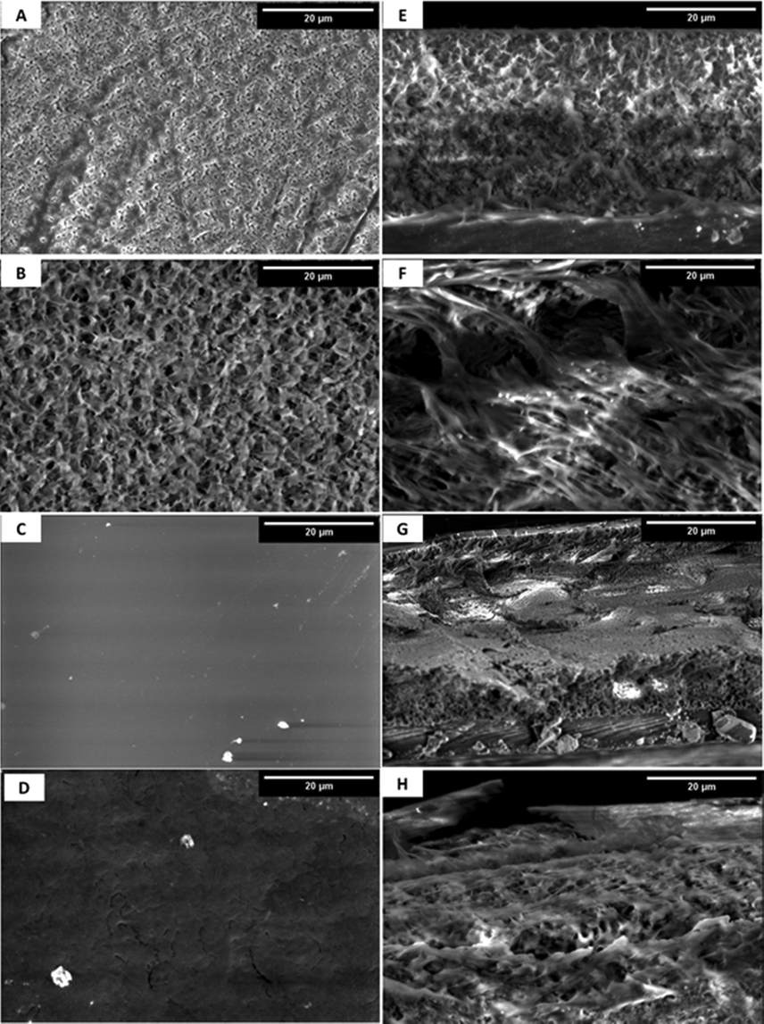 SEM images of A) PVDF, B) Al2O3-PVDF, C) Al2O3-PVDF/Cs, and D) Al2O3-PVDF/Cs- MWCNTs and their cross-sections (E-H), respectively.