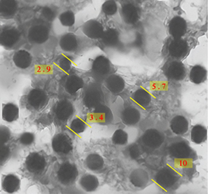 Transmission electron microscopy (TEM) micrograph of iron coated with gold nanoparticle.