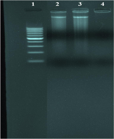 Agarose gel electrophoresis photography of the prepared azomethine complexes. Lane 1: DNA Ladder, lane 2: VOL complex + DNA, lane 3: ZnL(H2O)2 complex + DNA, lane 4: ZrOL complex + DNA.