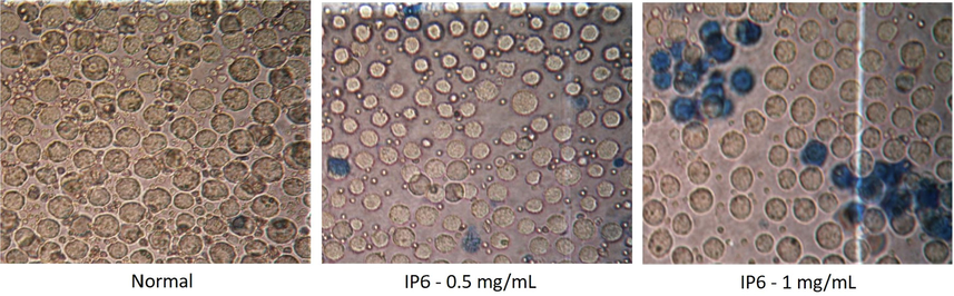 Cell viability assessment by trypan blue staining using various doses of IP6 at 40X magnification.