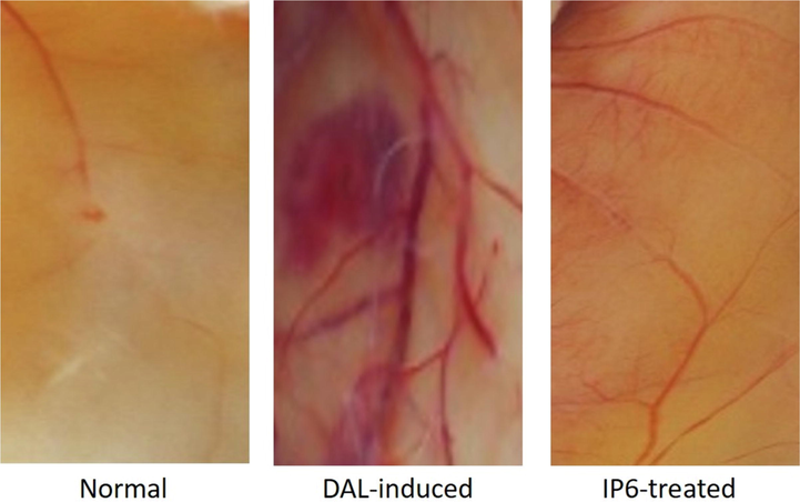 Anti-angiogenic effects as observed by changes in vessel growth of the peritoneal regions of normal, DAL-induced and IP6 treated mice.