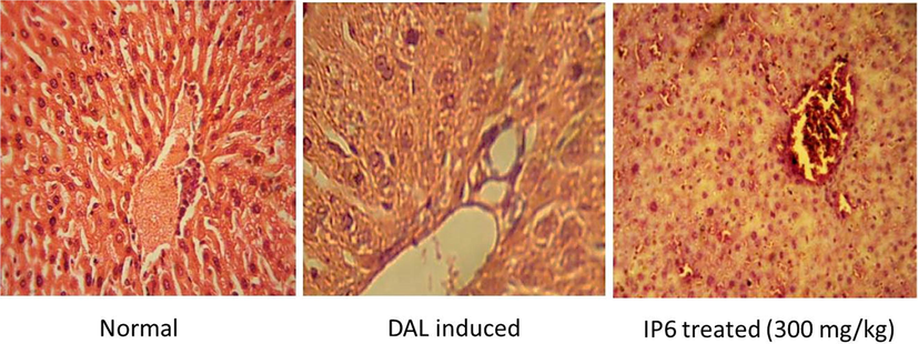 Histopathological examinations of livers of normal, DAL-induced and IP6 treated mice at 40X magnification.