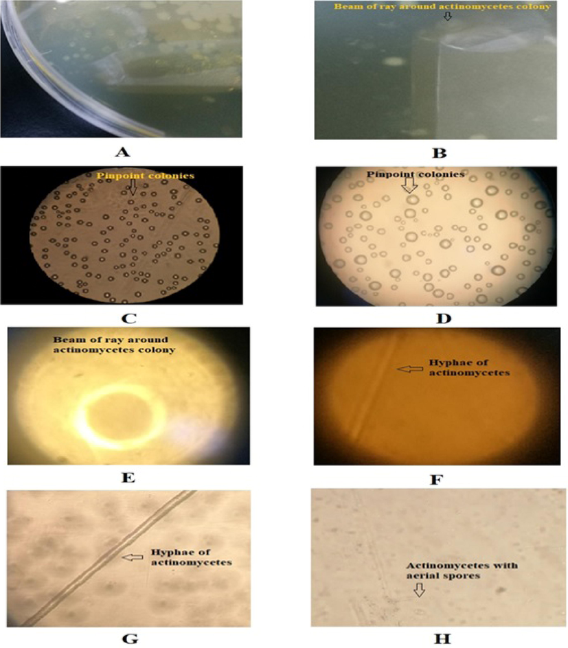 Growth pattern and morphological characters of Actinomycetes. (A) Growth of actinomycetes as pinpoint colonies on the agar surface; (B) A sunbeam of ray-like structure observed around pinpoint colonies; (C) Pinpoint colonies of actinomycetes on the agar surface mounted under phase contrast microscope at 150 × magnification ; (D) Pinpoint colonies of actinomycetes on the agar surface mounted under phase contrast microscope at 300 × magnification; (E) A sunbeam of ray-like structure observed around pinpoint colonies focused under phase contrast microscope at 600 × magnification; (F) Hyphae of mycelium of actinomycetes mounted on the slide under phase contrast microscope at 150 × magnification; (G) Hyphae of mycelium of actinomycetes mounted on the slide under phase contrast microscope at 600 × magnification; (H) Hyphae of mycelium of actinomycetes under phase contrast microscope at 300 × magnification on the agar surface, showing aerial spores.