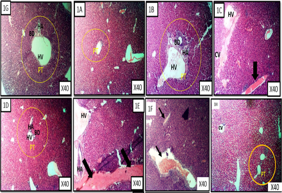 Liver representative photomicrograph of leukaemic mice and treated with fractions of M. lucida. MG X40, H&E stain. Fig. 6 1A is a representative of the n-hexane fraction treated group. Fig. 6 1B is a representative of chloroform fraction treated group. Fig. 6 1C is a are representatives of ethyl acetate fraction treated group. Fig. 6 1D is a representative of the n-butanol fraction treated group. Fig. 6 1E is a representative of the aqueous fraction treated group. Fig. 6 1F is a representative of the untreated group . Fig. 6 1G is a representative of the control treated group. Fig. 6 1H is a representative of the 5-florouracil treated group.