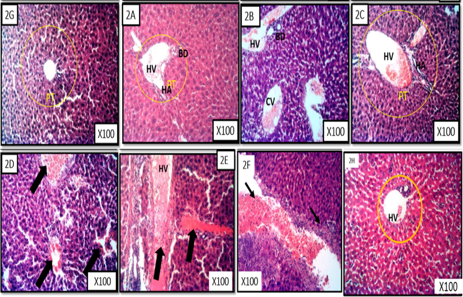 Liver representative photomicrograph of leukaemic mice and treated with fractions of M. lucida. MG X100, H&E stain. Fig. 6 2A is a representative of the n-hexane fraction treated group. Fig. 6 2B is a representative of chloroform fraction treated group. Fig. 6 2C is a representative of ethyl acetate fraction treated group. Fig. 6 2D is a representative of the n-butanol fraction treated group. Fig. 6 2E is a representative of the aqueous fraction treated group. Fig. 6 2F is a representative of the untreated group. Fig. 6 2G is a representative of the control treated group. Fig. 6 2H is a representative of the 5-florouracil treated group.