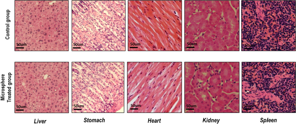 Histological analysis of in control and treated group (quince seeds mucilage - sodium alginate - cefixime loaded microspheres.