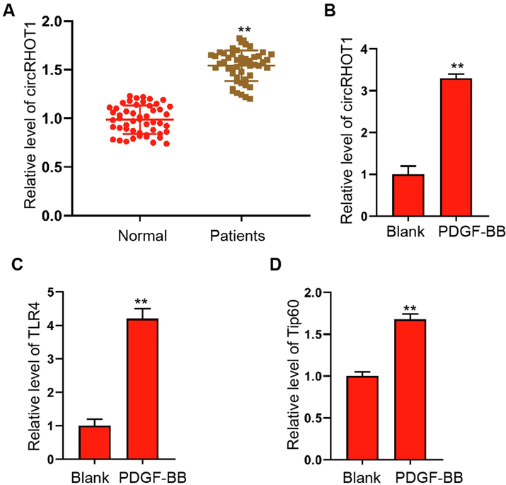 The expression of circRHOT1 is upregulated in the serum of patients with asthma and PDGF-BB-stimulated ASMCs. (A) QRT-PCR quantification of circRHOT1 level in the serum collected from patients with asthma (n = 50) and healthy donors (n = 50). (B-D) ASMCs were stimulated with PDGF-BB (25 ng/ml) for 24 h, the levels of circRHOT1, TLR4, and Tip60 were detected by qRT-PCR assay. **p < 0.01.