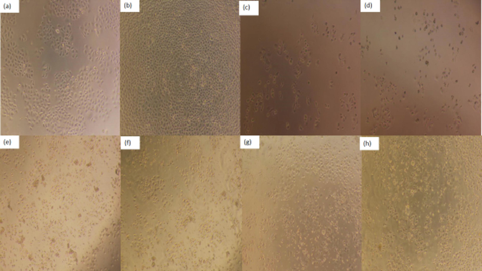 Effect of PPCMR on morphology of HepG2 cells. (a) Negative control group (24 h); (b) Negative control group (48 h); (c) 150 µg/mL 5-FU treatment group (24 h); (d) 150 µg/mL 5-FU treatment group (48 h). (e) 750 µg/mL PPCMR treatment group (24 h); (f) 750 µg/mL PPCMR treatment group (48 h); (g) 900 µg/mL PPCMR treatment group (24 h); (h) 900 µg/mL PPCMR treatment group (48 h).