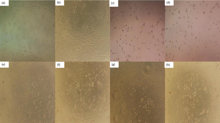 Effect of PPCMR on morphology of NCIH460 cells. (a) Negative control group (24 h); (b) Negative control group (48 h); (c) 150 µg/mL 5-FU treatment group (24 h); (d) 150 µg/mL 5-FU treatment group (48 h); (e) 750 µg/mL PPCMR treatment group (24 h); (f) 750 µg/mL PPCMR treatment group (48 h); (g) 900 µg/mL PPCMR treatment group (24 h); (h) 900 µg/mL PPCMR treatment group (48 h).