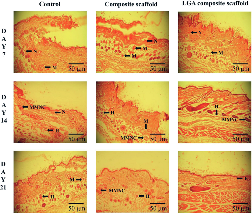 Histological changes during the wound healing process in STZ induced diabetes wistar albino rat skin on days 7, 14, and 21 without (control) and with treatment (Composite scaffold and LGA composite scaffold) in a full-thickness excision wound model; neutrophils (N), macrophage (M), histiocytes (H), massive multinucleated cell (MMNC), fibroblast (F).