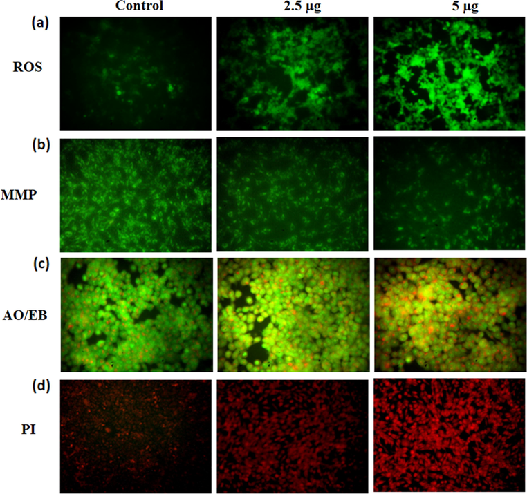 Effect of synthesized CSP-Cr-NCs on the ROS production, MMP level, and apoptosis in the KYSE-150 cells. The increased green fluorescence was noted on the 2.5 and 5 μg of CSP-Cr-NCs treated KYSE-150 cells than control that proves the higher ROS generation (a). The 2.5 and 5 μg of CSP-Cr-NCs administered KYSE-150 cells exhibited the depleted green fluorescence than control cells that suggest the reduced MMP level (b). The 2.5 and 5 μg of formulated CSP-Cr-NCs treated KYSE-150 cells revealed a higher yellow/orange fluorescence than control that proves the apoptotic cell deaths (c). The KYSE-150 cells supplemented with 2.5 and 5 μg of formulated CSP-Cr-NCs exhibited the increased red fluorescence than control, which evidenced the elevated apoptotic cell death (d).