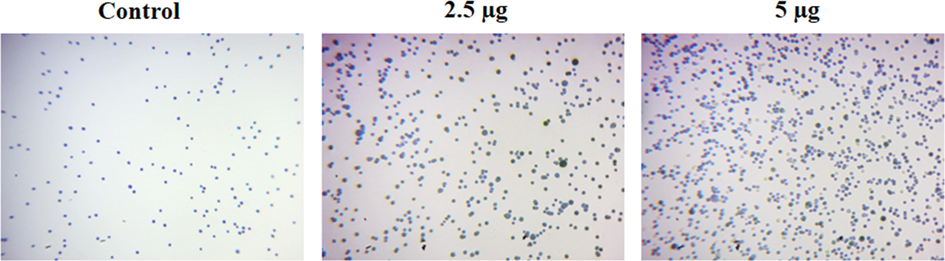 Effect of synthesized CSP-Cr-NCs treatment on the KYSE-150 cell viability. The treatment with the 2.5 and 5 µg of formulated CSP-Cr-NCs demonstrated the augmented trypan blue stained cells than control, which confirms the higher cell death.