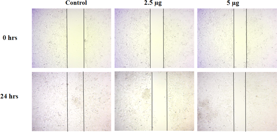 Effect of CSP-Cr-NCs treatment on the cell migration of KYSE-150 cells. The KYSE-150 cells administered with 2.5 and 5 µg of synthesized CSP-Cr-NCs demonstrated reduced wound closure rate, while untreated control cells showed increased wound closure level, suggest that CSP-Cr-NCs treatment inhibited the migration of KYSE-150 cells.