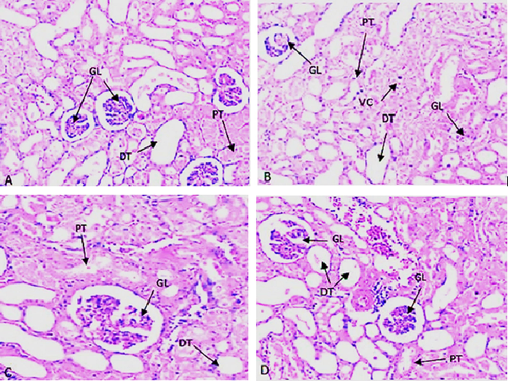 (A to D). Histopathological changes by H&E staining represents (A) Normal control with clear glomerular basement membrane (GL), normal proximal tubule (PT), Distal convoluted tubule (DT) and no vacuolization(VC); (B) ST group with clear damages in GL, PT, DT along with debris in duct and also seen Vacuolization(VC). (C) ST and drug treatment group (4-(4-hydroxy-3-methoxyphenyl)-2-butatone) with significant improve in GL, PT, DT and disappearing of Vacuolization. (D) Drug treatment (4-(4-hydroxy-3-methoxyphenyl)-2-butatone) with no significant changes in GL, PT, and DT etc.