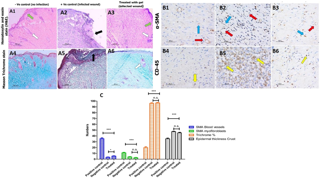 Histological analysis of wounded skin section from different rat groups at day 17 post wounding. A1-3) hematoxylin and eosin (H&E) staining, ×100 showing in A1) the non-infected, non-treated group epidermal re-epithelialization (green arrow) with the regeneration of the skin appendages (white arrow). A2) the non-treated group shows epidermal ulceration and crust formation (black arrow). A3) shows thick epidermal re-epithelialization (green arrow) with the regeneration of the skin appendages (white arrow). A4-6) Masson's trichrome staining × 100 shows (A6) the remodeling phase of healing in the third group treated with the gel, similar to the (A4) non-infected group. In contrast, the healing process in (A5) the second group is delayed representing the inflammatory phase in the form of extensive inflammation and granulation tissue with the least amount of fibrous tissue, B1-3) immunohistochemistry staining for α-SMA, x400 highlights the blood vessels (red arrow) and myofibroblasts (blue arrow) of the granulation tissue representing the complete maturation of the wound healing with few residual amount of granulation tissue in groups (B1) without infection and (B3) infected and treated. In contrast, in (B2), the infected untreated group shows the highest granulation tissue. B4-6) immunohistochemistry for CD-45, x400, reveals the least amount of lymphocytes (yellow arrow) in (B4) the first and (B6) third groups, representing the healing process's completion. C) The comparison of all histological analyses and the results of the histological analysis were carried out five times (n = 5).