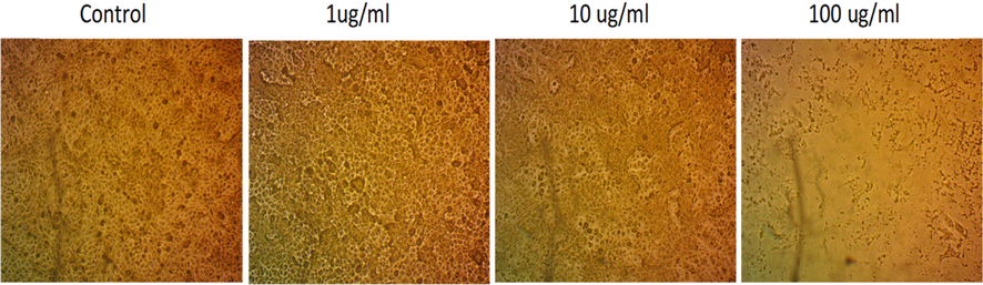 Microscopic images of Human Skin Fibroblast (HSF). Cells were treated with bee venom at different concentrations without adding a stain.