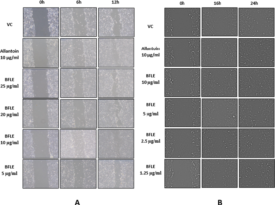 Migration of A) HaCaT against BFLE at 0, 6 and 12 h and B) BJ against BFLE at 0, 16 and 24 h. Data were presented as representative of image from three independent experiment taken from respective samples and time intervals.