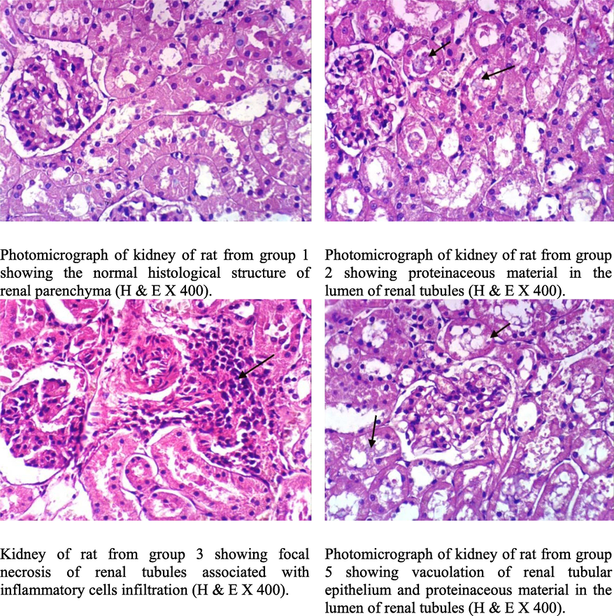 Kidney of rat.