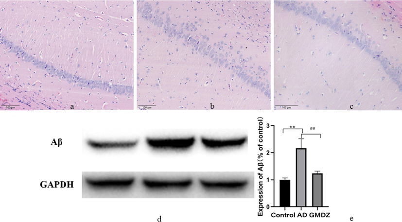 Gan Mai Da Zao decoction alleviated the pathological changes and the expression of Aβ in the hippocampus of in AD rats. (a, histopathology examination of control group; b, histopathology examination of AD group; c, histopathology examination of GMDZ group, d, the expression of Aβ in the hippocampus of rats; e, statistical result of Aβ expression level according to the grayscale value, ** indicated that the expression of Aβ is significantly increased compared to the control group, and P ≤ 0.01. ## represented a significant decrease in GMDZ group compared to the AD group, p ≤ 0.01; each group n = 8).