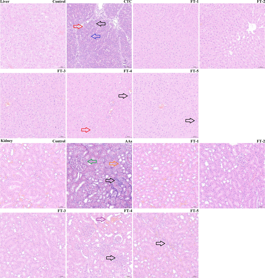 Histopathology of liver and kidney of rats after treatment with FT extract in comparison. Red arrow: fatty degeneration of liver; Blue arrow: dilated liver sinusoids; Black arrow: inflammatory cell infiltration; Green arrow: glomerular capillary loops hyperemia; Orange arrow: denaturation of the renal tubular epithelial cells; Purple arrow: renal tubular distension.