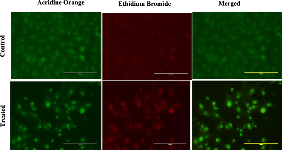 Dual staining of MCF-7 by Acridine orange and Ethidium bromide shows the apoptotic activity of compound 5b on MCF-7 cell (control and treated) after 24 h of treatment.