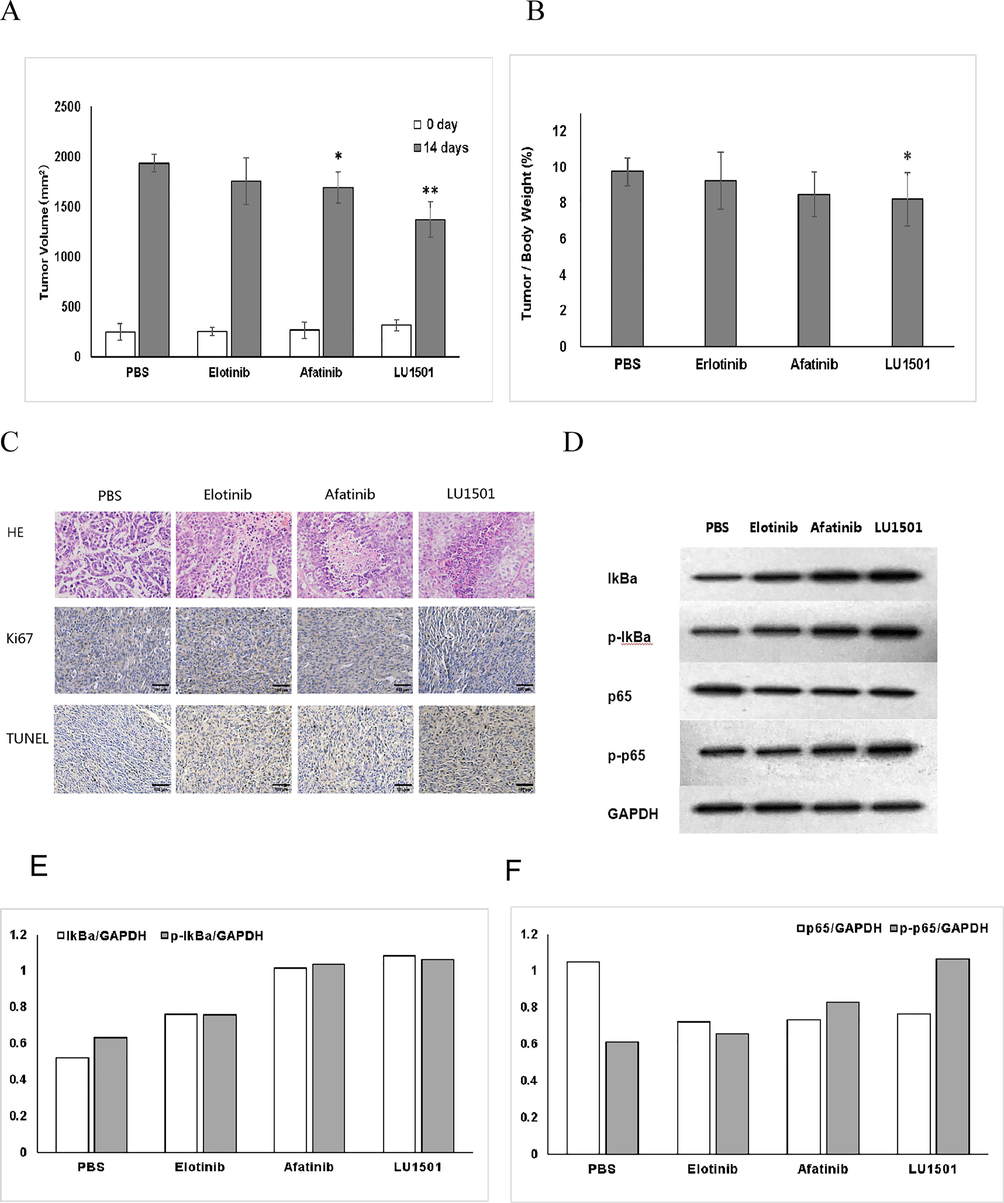 (A) Tumor-bearing mice of different groups. (B) Tumor volumes after 14 days treatment. (C) HE, Tunel analysis and protein Ki-67 was analyzed by IHC staining. (D) The expression levels of EGFR/ NF-κb pathway related proteins in vivo were evaluated using Western blot analysis. *p < 0.05, **p < 0.01 when compared with control group. (E) Corresponding grayscale values analysis of EGFR/NF-κb p65 and p-p65. (F) Corresponding grayscale values analysis of EGFR/NF-κb IkBα and p-IkBα.