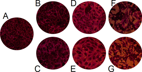 Morphological alteration of treated PC-3. Control (A without treatment), 100 μg/mL (B) and 150 μg/ mL (C) of AgNO3; 100 μg/ mL (D) and 150 μg/ mL (E) of D. caffra fruit extract; 100 μg/ mL (F) and 150 μg/ mL (G) of AgNPs.