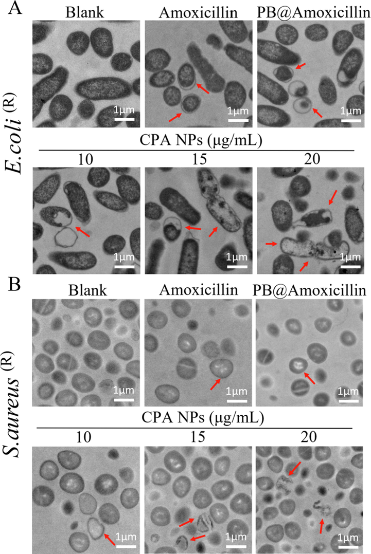 Morphological changes of E. coli (R) (A) and S. aureus (R) (B) Treated with Amoxicillin, PB@Amoxicillin and CPA NPs (10,15 and 20 μg/mL) through TEM observation. Assay without NPs is as blank. The red arrow points to the broken part of the bacterial cell membrane.