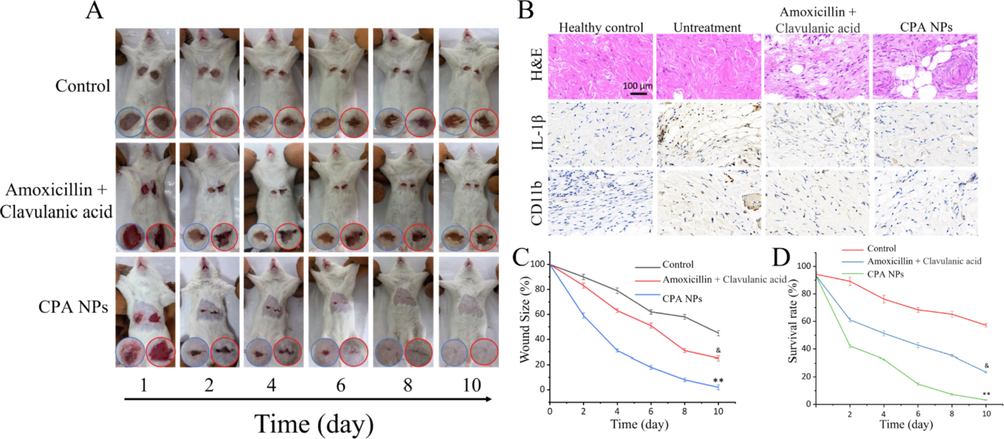 (A)Representative photos of wounds infected with bacteria treated with Amoxicillin + Clavulanic acid or CPA NPs (and untreated mice used as controls) (B) H&E staining images and immunohistochemical results of the wound tissue sections; (C) Diagram of the change in wound size over time after MDR bacterial infection (&p < 0.05, &&p < 0.01 Amoxicillin + Clavulanic acid treatment group and control group; *p < 0.05, **p < 0.01 CPA NPs treatment group and control group); (D) Count statistics of bacterial cultures in tissues of untreated and CPA NPs-treated wounds; Each value represents the mean standard deviation (n = 3).