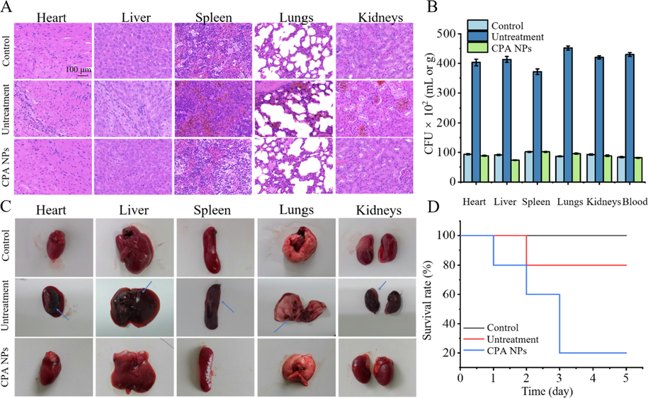 (A) Histological methods were used to detect the bacteremia model of CPA NPs and the therapeutic effect. The main organs of the mice were examined histologically after 5 days S. aureus (R) intravenously. Compared with the blank group, the infected group had inflammatory cells. The concentration of NPs is 20 μg/mL. (B) Bacterial burden in heart, liver, spleen, lungs, kidneys and blood. (C) Representative images of organs treated with saline (control group), S. aureus (R) (untreatment group), S. aureus (R) + CPA NPs (treatment group) for 5 days. Observe inflammatory symptoms and lesions on imaging. The blue arrow indicates necrosis and abscess. The concentration of NPs is 20 μg/mL. (D) Five-day survival rate of mice infected by S. aureus (R) infection.