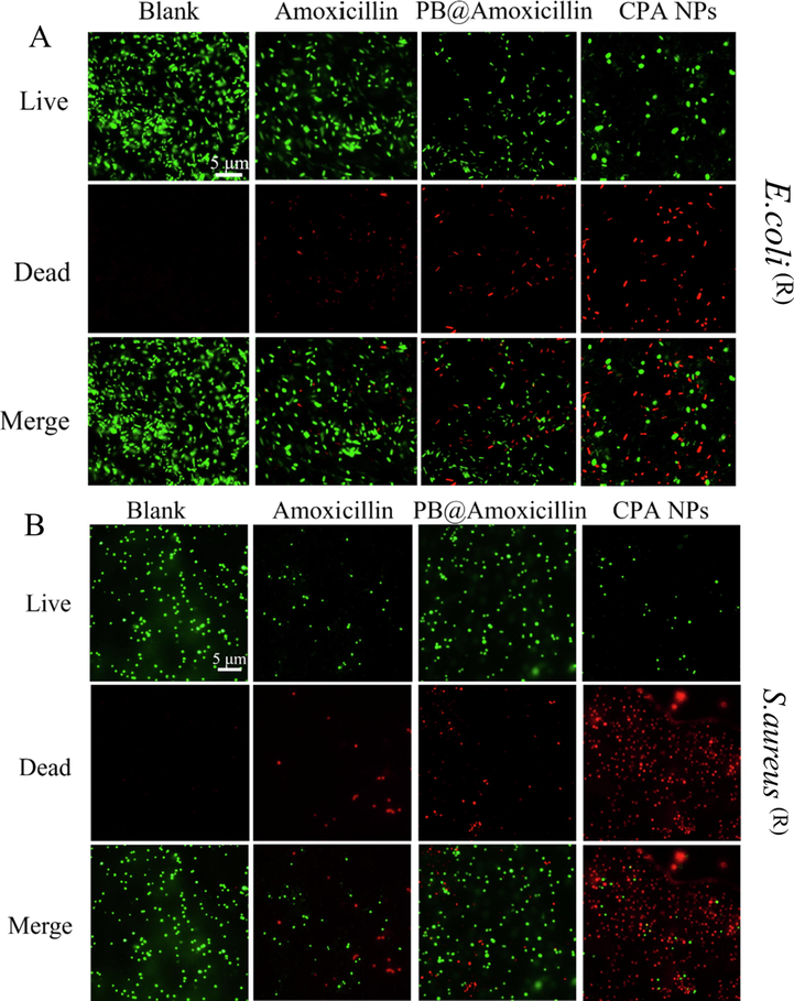 Fluorescence microscopic images of drug-resistant E. coli (R) (A) and S. aureus (R) (B) through the LIVE-DEAD stained assay. Cells treated with Amoxicillin (20 μg/mL), PB@Amoxicillin (20 μg/mL), CPA NPs (20 μg/mL) were set as control groups. Cells were treated with CPA NPs (20 μg/mL) for 2 h in incubation. The blank group is bacteria without NPs.