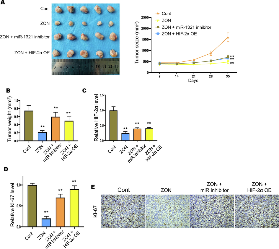 ZONs suppress Oxa-resistant CRC cells tumorigenesis in vivo. Xenograft tumor model was established to determine the in vivo effect of ZONs. Tumor images and growth cure (A) and tumor weight (B) were detected. (C and D) The RNA levels of HIF-2α and KI-67 were detected by qRT-PCR. (E) IHC staining of KI-67 protein. **p < 0.01.