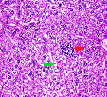 Liver sections from the experimental mice of the different study groups: Fig. 3a: section from the liver of GI, Fig. 3b: section from the liver of GII, Fig. 3c: section from the liver of GIII, Fig. 3d: section from the liver of GIV, Fig. 3e: section from the liver of GV. Fig. 3a. A section in the liver tissue of GI shows a normal hepatocyte pattern (H&E stain, X200). Fig. 3b. A section in liver tissue demonstrates moderate hepatocellular degeneration (green arrow) and focal mononuclear cellular infiltration (red arrow) (H&E stain, X400). Fig. 3c. A liver section of GIII reveals degenerated hepatocytes (green arrow) and focal mononuclear cellular infiltration (red arrow) (H&E stain, X400). Fig. 3d. A section in the liver tissue reveals mild hepatocellular degeneration (H&E stain, X200). Fig. 3e. A section in the liver tissue presents preserved hepatic lobular architecture (H&E stain, X200).