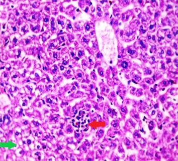 Liver sections from the experimental mice of the different study groups: Fig. 3a: section from the liver of GI, Fig. 3b: section from the liver of GII, Fig. 3c: section from the liver of GIII, Fig. 3d: section from the liver of GIV, Fig. 3e: section from the liver of GV. Fig. 3a. A section in the liver tissue of GI shows a normal hepatocyte pattern (H&E stain, X200). Fig. 3b. A section in liver tissue demonstrates moderate hepatocellular degeneration (green arrow) and focal mononuclear cellular infiltration (red arrow) (H&E stain, X400). Fig. 3c. A liver section of GIII reveals degenerated hepatocytes (green arrow) and focal mononuclear cellular infiltration (red arrow) (H&E stain, X400). Fig. 3d. A section in the liver tissue reveals mild hepatocellular degeneration (H&E stain, X200). Fig. 3e. A section in the liver tissue presents preserved hepatic lobular architecture (H&E stain, X200).