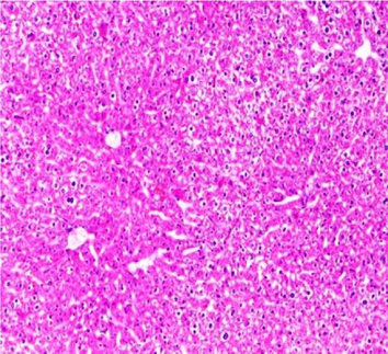 Liver sections from the experimental mice of the different study groups: Fig. 3a: section from the liver of GI, Fig. 3b: section from the liver of GII, Fig. 3c: section from the liver of GIII, Fig. 3d: section from the liver of GIV, Fig. 3e: section from the liver of GV. Fig. 3a. A section in the liver tissue of GI shows a normal hepatocyte pattern (H&E stain, X200). Fig. 3b. A section in liver tissue demonstrates moderate hepatocellular degeneration (green arrow) and focal mononuclear cellular infiltration (red arrow) (H&E stain, X400). Fig. 3c. A liver section of GIII reveals degenerated hepatocytes (green arrow) and focal mononuclear cellular infiltration (red arrow) (H&E stain, X400). Fig. 3d. A section in the liver tissue reveals mild hepatocellular degeneration (H&E stain, X200). Fig. 3e. A section in the liver tissue presents preserved hepatic lobular architecture (H&E stain, X200).