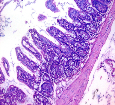 small intestinal (SI) sections from the experimental mice of the different study groups: Fig. 2a: section from SI of GI, Fig. 2b,c: section from SI of GII, Fig. 2d: section from SI of GIII, Fig. 2e: section from SI of GIV, Fig. 2f: section from SI of GV. Fig. 2a. Small intestinal sections demonstrate normal intestinal villi (H&E stain, X200). Fig. 2b. Small intestinal sections reveal significant villous broadening (red line). There was dense infiltration by mononuclear inflammatory cells (yellow arrows) and degeneration of the villous tip-regions (green arrows) (H&E stain, X200). Fig. 2c. Histopathological examination of sections from the small intestine shows many adherents (red arrow) and separate (green arrow) cryptosporidium oocysts. (H&E stain, X1000). Fig. 2d. GIII small intestinal sections reveal moderate villous broadening (red line), infiltration by mononuclear inflammatory cells (yellow arrow) and focal degeneration of the villous tip regions (green arrow) (H&E stain, X200). Fig. 2e. Small intestinal sections show improved pathological changes in the villi with mild expansion by mononuclear inflammatory cells as shown by (red arrow). (H&E stain, X200). Fig. 2f. Small intestinal section demonstrates a nearly normal villous pattern (H&E stain, X200).