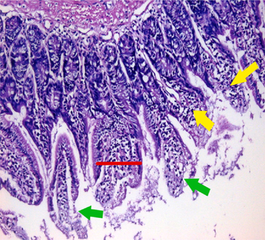 small intestinal (SI) sections from the experimental mice of the different study groups: Fig. 2a: section from SI of GI, Fig. 2b,c: section from SI of GII, Fig. 2d: section from SI of GIII, Fig. 2e: section from SI of GIV, Fig. 2f: section from SI of GV. Fig. 2a. Small intestinal sections demonstrate normal intestinal villi (H&E stain, X200). Fig. 2b. Small intestinal sections reveal significant villous broadening (red line). There was dense infiltration by mononuclear inflammatory cells (yellow arrows) and degeneration of the villous tip-regions (green arrows) (H&E stain, X200). Fig. 2c. Histopathological examination of sections from the small intestine shows many adherents (red arrow) and separate (green arrow) cryptosporidium oocysts. (H&E stain, X1000). Fig. 2d. GIII small intestinal sections reveal moderate villous broadening (red line), infiltration by mononuclear inflammatory cells (yellow arrow) and focal degeneration of the villous tip regions (green arrow) (H&E stain, X200). Fig. 2e. Small intestinal sections show improved pathological changes in the villi with mild expansion by mononuclear inflammatory cells as shown by (red arrow). (H&E stain, X200). Fig. 2f. Small intestinal section demonstrates a nearly normal villous pattern (H&E stain, X200).