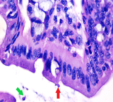 small intestinal (SI) sections from the experimental mice of the different study groups: Fig. 2a: section from SI of GI, Fig. 2b,c: section from SI of GII, Fig. 2d: section from SI of GIII, Fig. 2e: section from SI of GIV, Fig. 2f: section from SI of GV. Fig. 2a. Small intestinal sections demonstrate normal intestinal villi (H&E stain, X200). Fig. 2b. Small intestinal sections reveal significant villous broadening (red line). There was dense infiltration by mononuclear inflammatory cells (yellow arrows) and degeneration of the villous tip-regions (green arrows) (H&E stain, X200). Fig. 2c. Histopathological examination of sections from the small intestine shows many adherents (red arrow) and separate (green arrow) cryptosporidium oocysts. (H&E stain, X1000). Fig. 2d. GIII small intestinal sections reveal moderate villous broadening (red line), infiltration by mononuclear inflammatory cells (yellow arrow) and focal degeneration of the villous tip regions (green arrow) (H&E stain, X200). Fig. 2e. Small intestinal sections show improved pathological changes in the villi with mild expansion by mononuclear inflammatory cells as shown by (red arrow). (H&E stain, X200). Fig. 2f. Small intestinal section demonstrates a nearly normal villous pattern (H&E stain, X200).