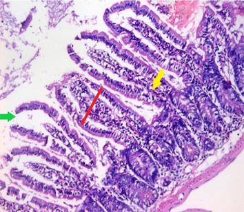 small intestinal (SI) sections from the experimental mice of the different study groups: Fig. 2a: section from SI of GI, Fig. 2b,c: section from SI of GII, Fig. 2d: section from SI of GIII, Fig. 2e: section from SI of GIV, Fig. 2f: section from SI of GV. Fig. 2a. Small intestinal sections demonstrate normal intestinal villi (H&E stain, X200). Fig. 2b. Small intestinal sections reveal significant villous broadening (red line). There was dense infiltration by mononuclear inflammatory cells (yellow arrows) and degeneration of the villous tip-regions (green arrows) (H&E stain, X200). Fig. 2c. Histopathological examination of sections from the small intestine shows many adherents (red arrow) and separate (green arrow) cryptosporidium oocysts. (H&E stain, X1000). Fig. 2d. GIII small intestinal sections reveal moderate villous broadening (red line), infiltration by mononuclear inflammatory cells (yellow arrow) and focal degeneration of the villous tip regions (green arrow) (H&E stain, X200). Fig. 2e. Small intestinal sections show improved pathological changes in the villi with mild expansion by mononuclear inflammatory cells as shown by (red arrow). (H&E stain, X200). Fig. 2f. Small intestinal section demonstrates a nearly normal villous pattern (H&E stain, X200).