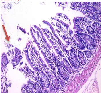 small intestinal (SI) sections from the experimental mice of the different study groups: Fig. 2a: section from SI of GI, Fig. 2b,c: section from SI of GII, Fig. 2d: section from SI of GIII, Fig. 2e: section from SI of GIV, Fig. 2f: section from SI of GV. Fig. 2a. Small intestinal sections demonstrate normal intestinal villi (H&E stain, X200). Fig. 2b. Small intestinal sections reveal significant villous broadening (red line). There was dense infiltration by mononuclear inflammatory cells (yellow arrows) and degeneration of the villous tip-regions (green arrows) (H&E stain, X200). Fig. 2c. Histopathological examination of sections from the small intestine shows many adherents (red arrow) and separate (green arrow) cryptosporidium oocysts. (H&E stain, X1000). Fig. 2d. GIII small intestinal sections reveal moderate villous broadening (red line), infiltration by mononuclear inflammatory cells (yellow arrow) and focal degeneration of the villous tip regions (green arrow) (H&E stain, X200). Fig. 2e. Small intestinal sections show improved pathological changes in the villi with mild expansion by mononuclear inflammatory cells as shown by (red arrow). (H&E stain, X200). Fig. 2f. Small intestinal section demonstrates a nearly normal villous pattern (H&E stain, X200).