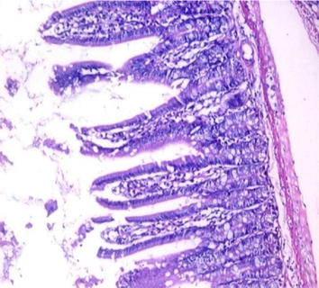 small intestinal (SI) sections from the experimental mice of the different study groups: Fig. 2a: section from SI of GI, Fig. 2b,c: section from SI of GII, Fig. 2d: section from SI of GIII, Fig. 2e: section from SI of GIV, Fig. 2f: section from SI of GV. Fig. 2a. Small intestinal sections demonstrate normal intestinal villi (H&E stain, X200). Fig. 2b. Small intestinal sections reveal significant villous broadening (red line). There was dense infiltration by mononuclear inflammatory cells (yellow arrows) and degeneration of the villous tip-regions (green arrows) (H&E stain, X200). Fig. 2c. Histopathological examination of sections from the small intestine shows many adherents (red arrow) and separate (green arrow) cryptosporidium oocysts. (H&E stain, X1000). Fig. 2d. GIII small intestinal sections reveal moderate villous broadening (red line), infiltration by mononuclear inflammatory cells (yellow arrow) and focal degeneration of the villous tip regions (green arrow) (H&E stain, X200). Fig. 2e. Small intestinal sections show improved pathological changes in the villi with mild expansion by mononuclear inflammatory cells as shown by (red arrow). (H&E stain, X200). Fig. 2f. Small intestinal section demonstrates a nearly normal villous pattern (H&E stain, X200).