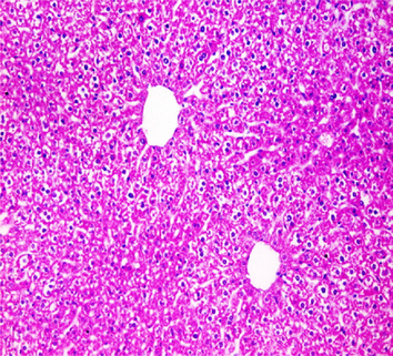 Liver sections from the experimental mice of the different study groups: Fig. 3a: section from the liver of GI, Fig. 3b: section from the liver of GII, Fig. 3c: section from the liver of GIII, Fig. 3d: section from the liver of GIV, Fig. 3e: section from the liver of GV. Fig. 3a. A section in the liver tissue of GI shows a normal hepatocyte pattern (H&E stain, X200). Fig. 3b. A section in liver tissue demonstrates moderate hepatocellular degeneration (green arrow) and focal mononuclear cellular infiltration (red arrow) (H&E stain, X400). Fig. 3c. A liver section of GIII reveals degenerated hepatocytes (green arrow) and focal mononuclear cellular infiltration (red arrow) (H&E stain, X400). Fig. 3d. A section in the liver tissue reveals mild hepatocellular degeneration (H&E stain, X200). Fig. 3e. A section in the liver tissue presents preserved hepatic lobular architecture (H&E stain, X200).