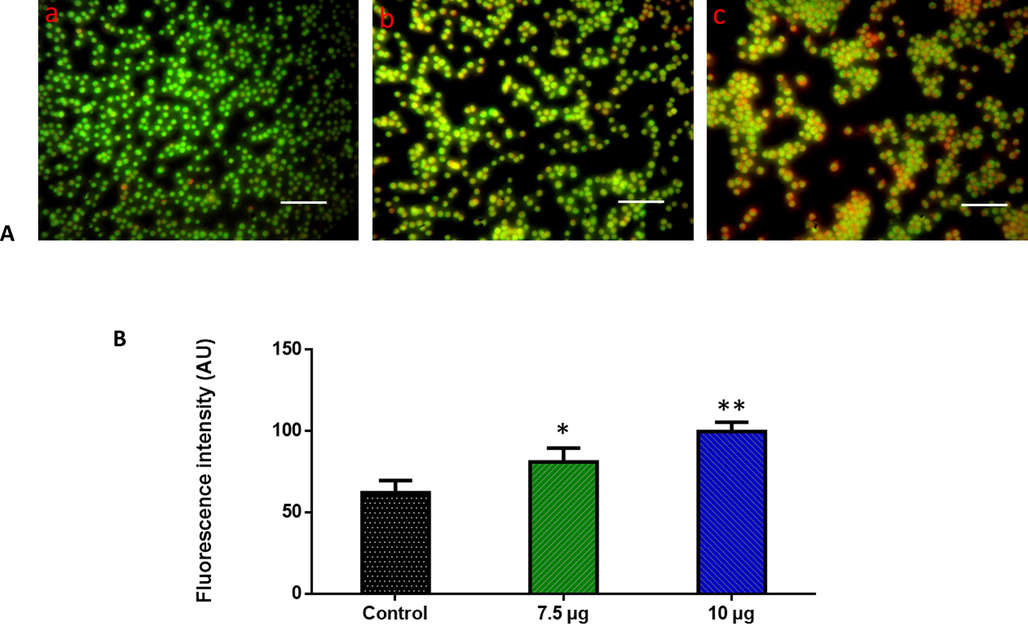 Effect of ZnO-TiO2-Chitosan-Amygdalin nanocomposites on the apoptotic cell death in the blood cancer MOLT-4 cells for 24 h. Acridine orange and ethidium bromide (1:1), was used to stain the cells, then analyzed by fluorescence microscopy (Labomed, USA). The control cells showed green fluorescence that indicates living cells without apoptosis. The ZnO-TiO2-Chitosan-Amygdalin nanocomposites tested cells showed yellow and orange fluorescence, which indicates early and late apoptotic cell death, respectively with condensed or fragmented nuclei and necrotic cells. Panel A; Control (a) (untreated cells), ZnO-TiO2-Chitosan-Amygdalin nanocomposites-treated cells; 7.5 µg/ml concentration (b) and 10 µg/ml concentration (c). Panel B; Arbitrary Units (a.u.) of fluorescent Intensity from the control and treated cells incubated at 37 °C were measured by a fluorescence microplate reader. *p < 0.05 compared to the “Control” group and **p < 0.005 compared to the “Control” group. Scale Bar = 25 µm.